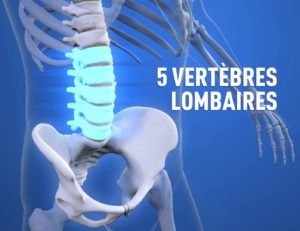 Fracture d'une vertèbre lombaire